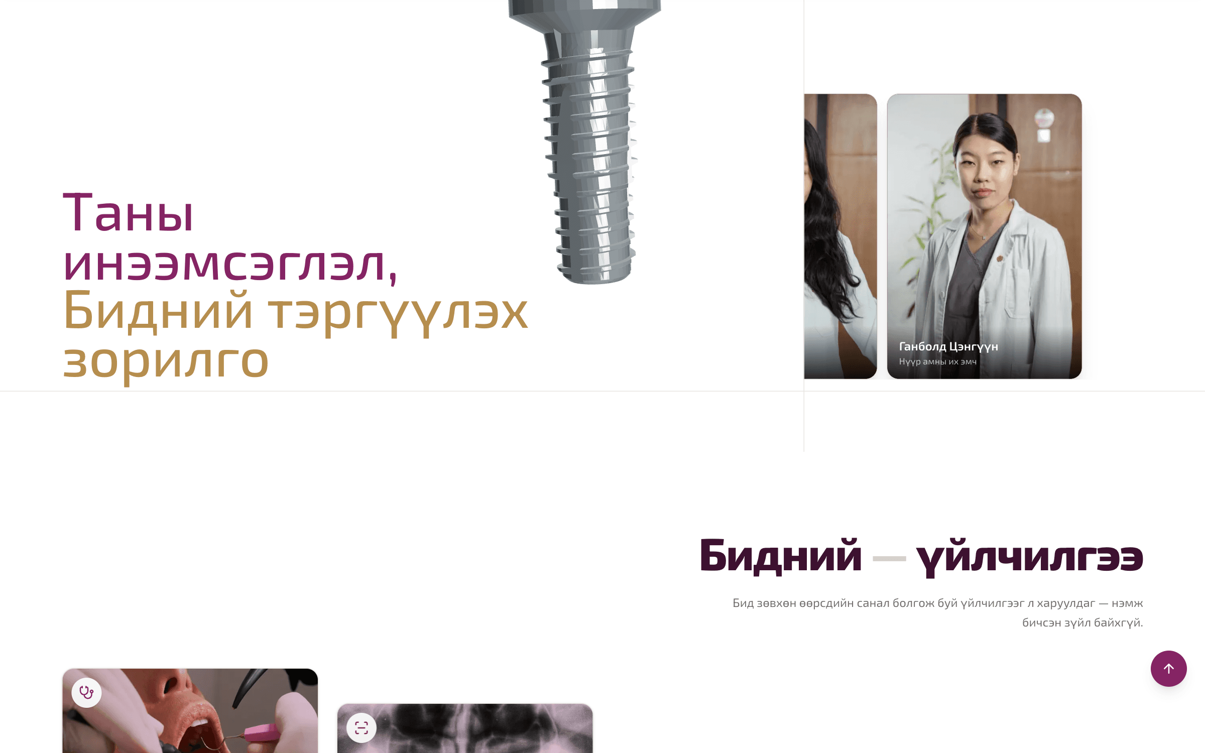 Саян Дент preview 2